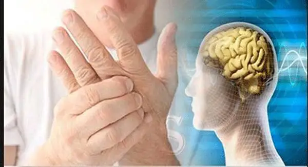 10 نشانه خاموش بیماری ام اس که جوانان را درگیر می کند - چرا زنان بیشتر از مردان به ام اس مبتلا می شوند؟