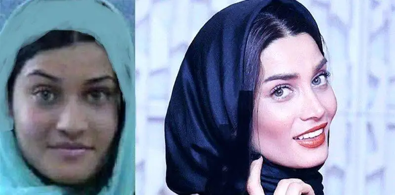 رونمایی از تصاویر قبل عمل زیبایی بازیگران زن ایرانی - از شیلا خداداد تا نیوشا ضیغمی+عکس