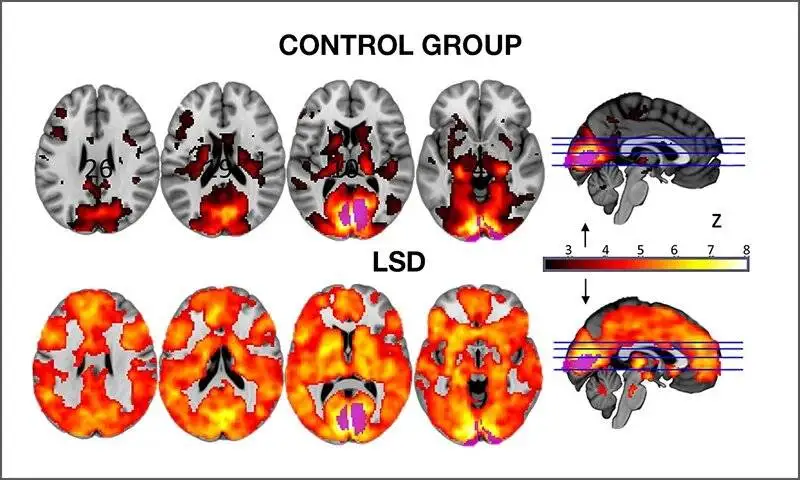 چطور مغزمان را از گذشته رها کنیم و آینده ای تازه بسازیم؟