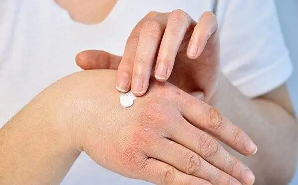 چطور مرطوب کننده مناسب پوست خود را انتخاب کنیم؟