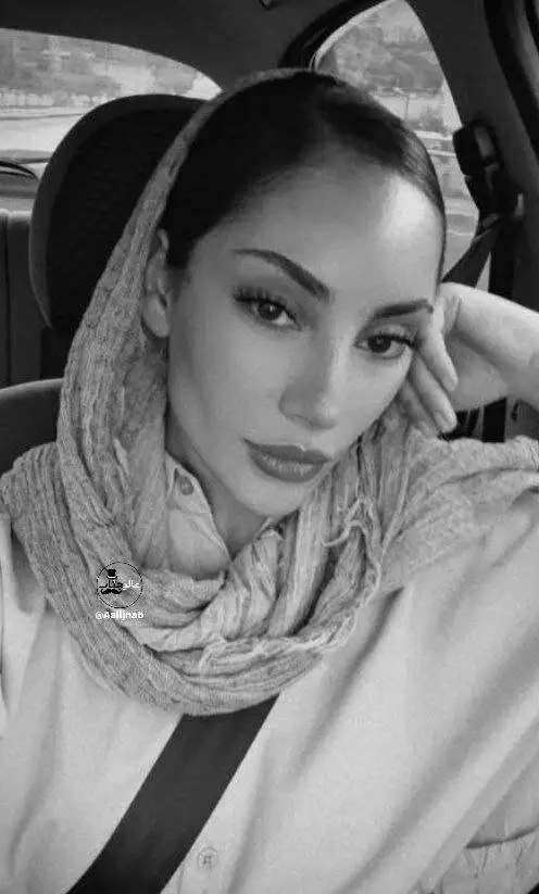 تصویر - تغییر چهره دوباره ترلان پروانه؛ این بازیگر زن چه کرده است؟