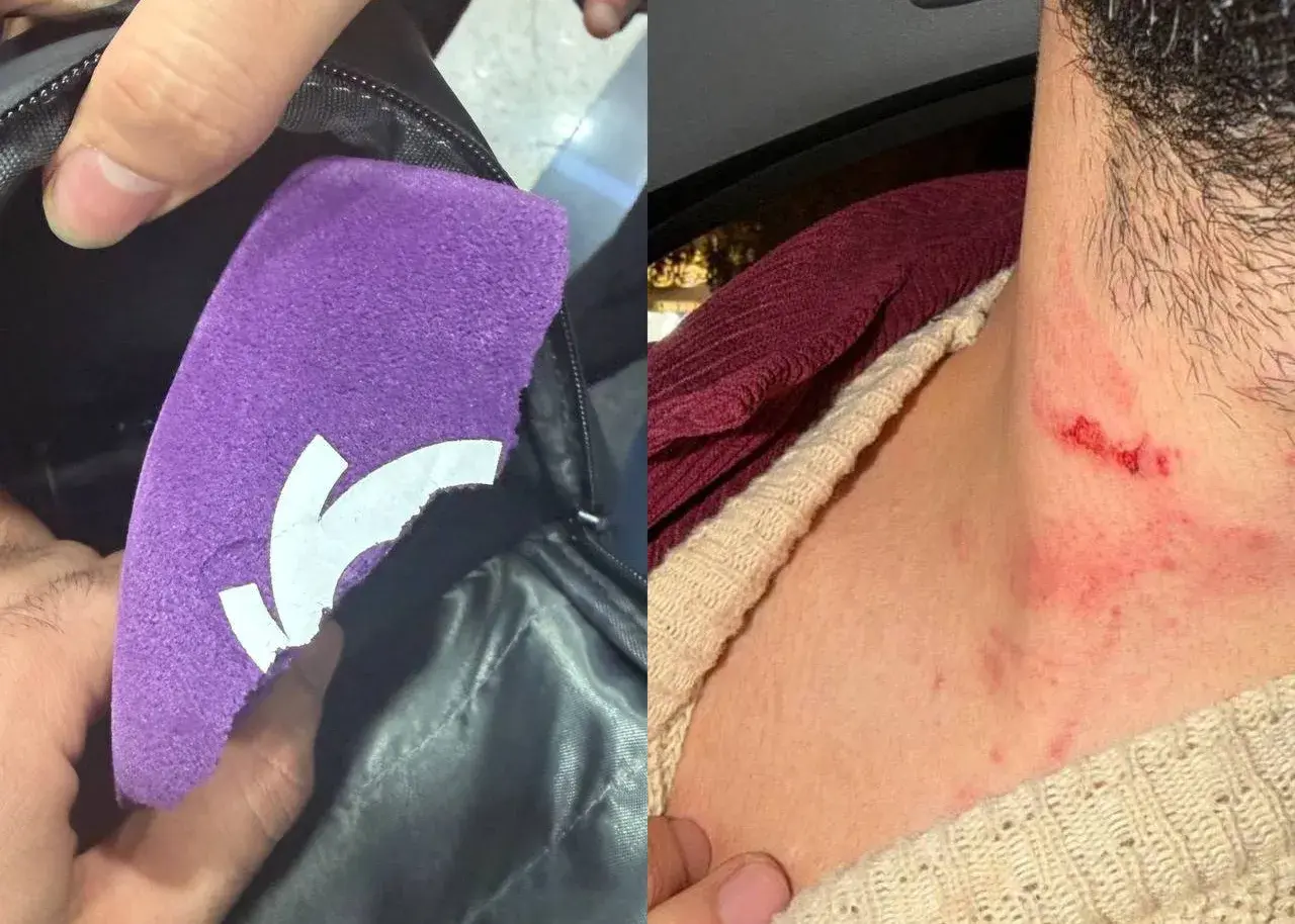 تصویر - اقدام باورنکردنی عوامل محمود فکری؛ ضرب و شتم خبرنگاران در تبریز!