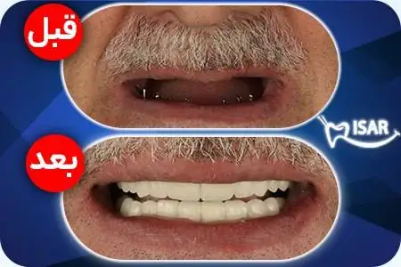 ویدیو - امیر مقاره: ماشین و خونه ندارم فقط یه موتور دارم - قیاسی: مردم تصور میکنن اینا پول پارو میکنن در حالیکه این شکلی نیست