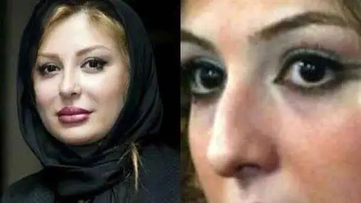 رونمایی از تصاویر قبل عمل زیبایی بازیگران زن ایرانی - از شیلا خداداد تا نیوشا ضیغمی+عکس