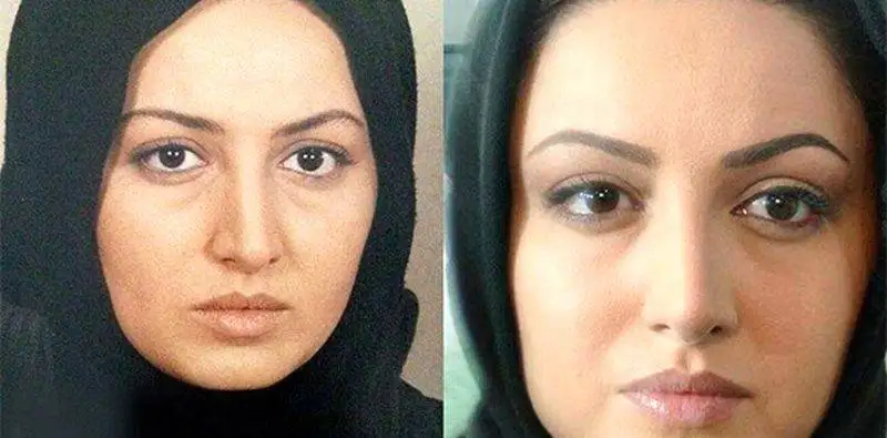 رونمایی از تصاویر قبل عمل زیبایی بازیگران زن ایرانی - از شیلا خداداد تا نیوشا ضیغمی+عکس