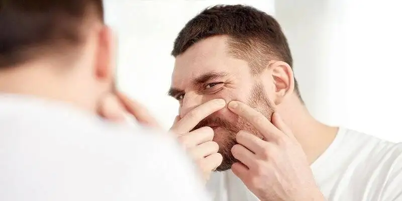 دلیل اصلی جوش چرکی چیست ؟ ؛ درمان خانگی جوش های چرکی و دردناک