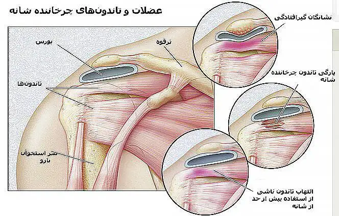چطور شانه ها را در خانه ورزش دهیم؟